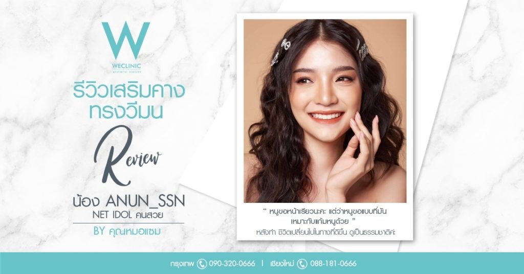 รีวิวเสริมคาง