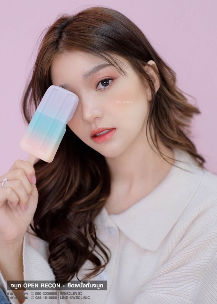 รีวิวเสริมจมูกแบบโอเพ่น