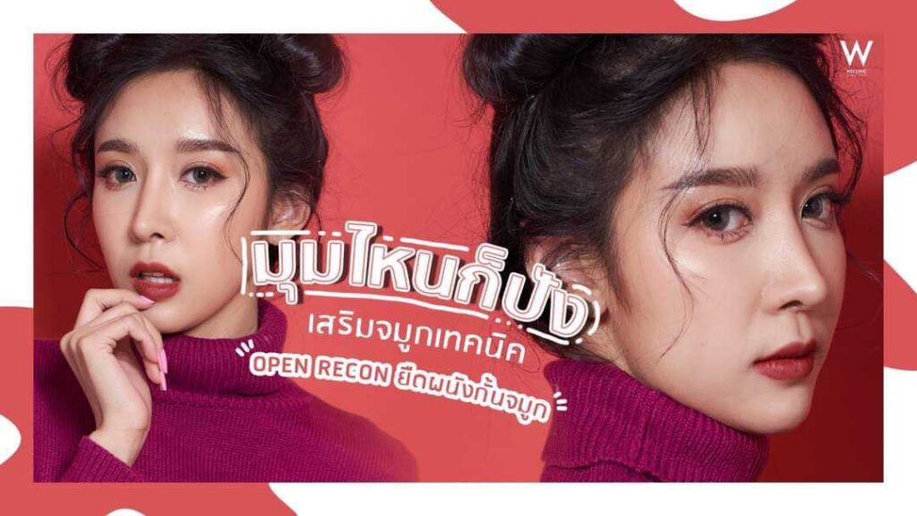 แก้จมูกงุ้ม ให้พุ่งสวย เทคนิคโอเพ่น ยืดผนังกั้นจมูก