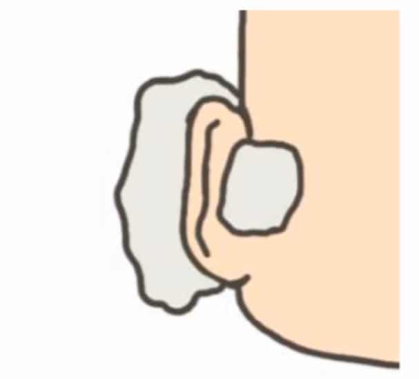 วิธีถอดผ้าก็อช ขั้นตอนที่ 1