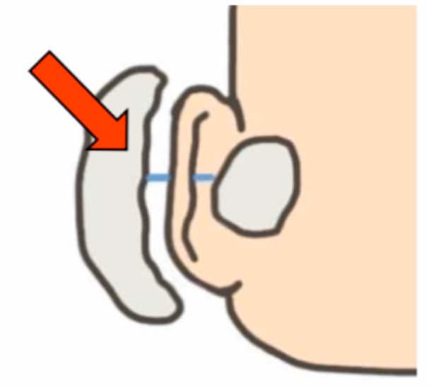 วิธีถอดผ้าก็อช ขั้นตอนที่ 2