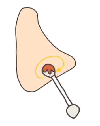 วิธีทำความสะอาดแผลบริเวณหลังหู