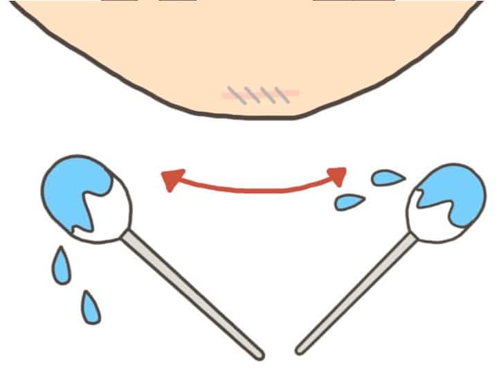 การทำความสะอาดแผลคางหลังทำคาง-ขั้นตอนที่-1