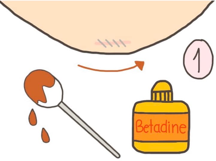 การทำความสะอาดแผลคางหลังทำคาง-ขั้นตอนที่-2