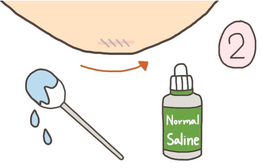 การทำความสะอาดแผลคางหลังทำคาง-ขั้นตอนที่-3