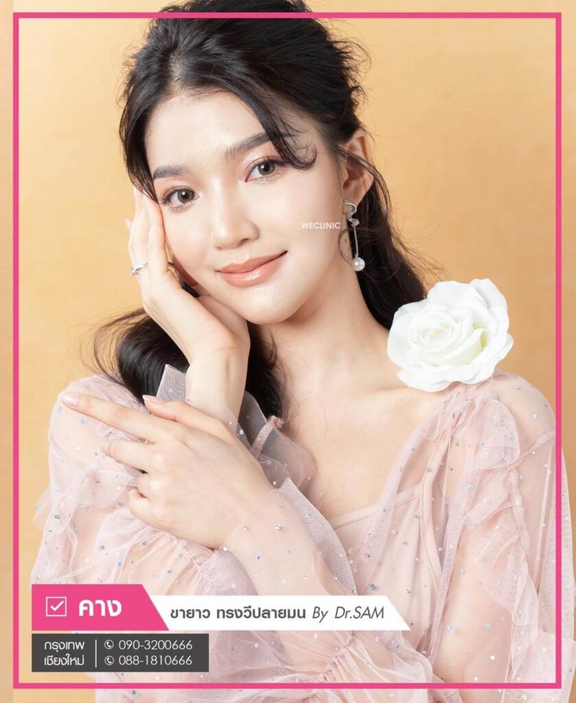 ทำคางแผลนอก-รีวิว