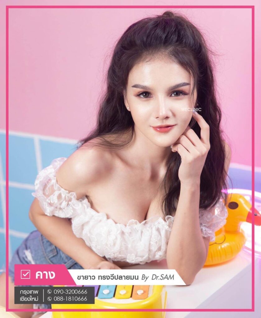 เสริมคางแผลนอก-รีวิว