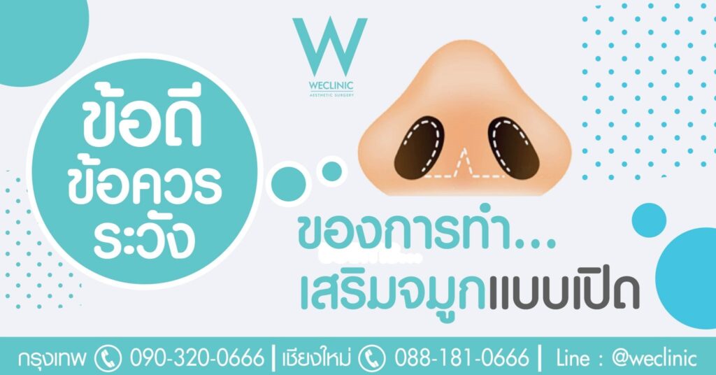 เสริมจมูกแบบโอเพ่น ดีอย่างไร ก่อนทำ ควรรู้ อะไรบ้าง