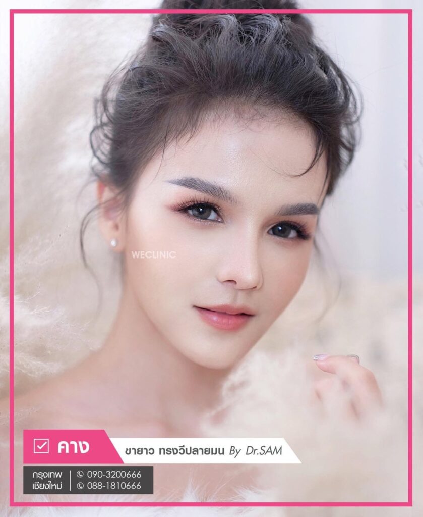 ซิลิโคนคาง ขายาว ทรงวีปลายมน