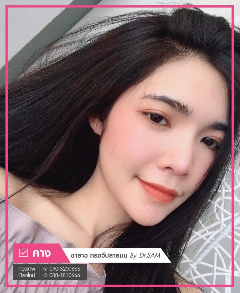 ซิลิโคนคาง-ขายาว-ยอดนิยม