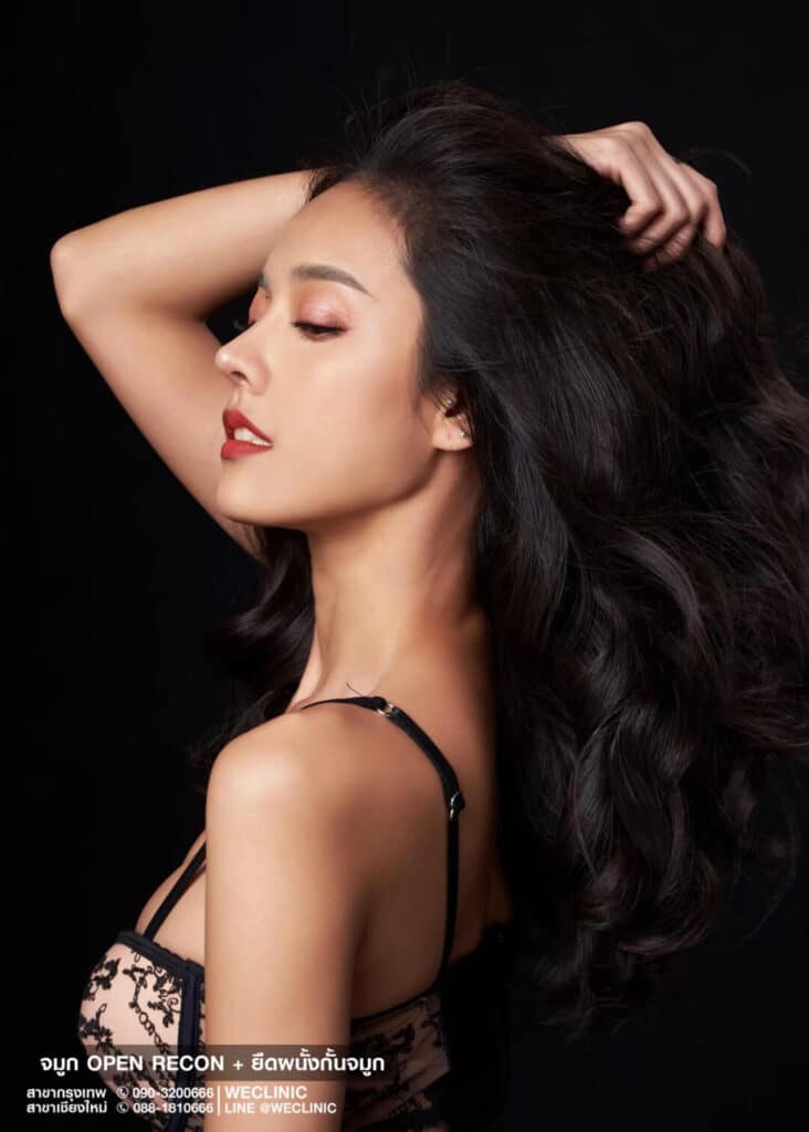 จมูกทรงปลายพุ่ง