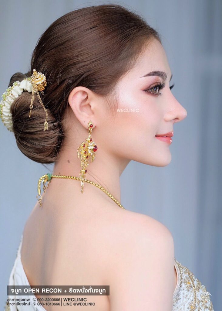 จมูกทรงสโลปธรรมชาติ