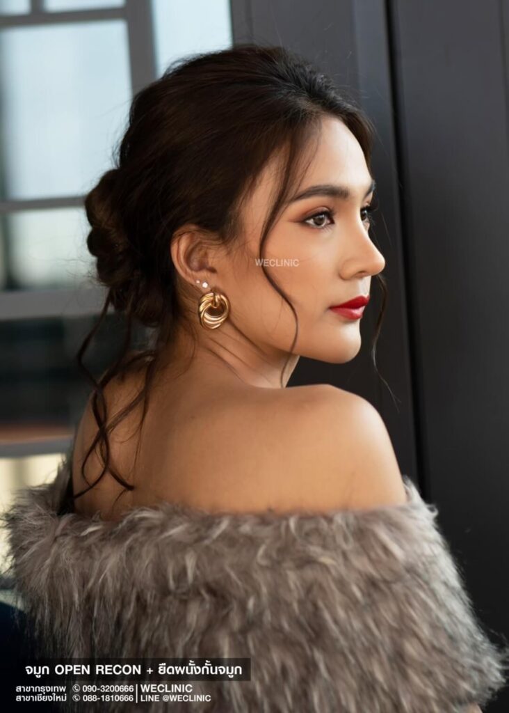 จมูกทรงสโลปปลายพุ่ง