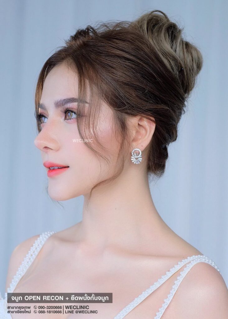 จมูกทรงสโลป ปลายพุ่ง