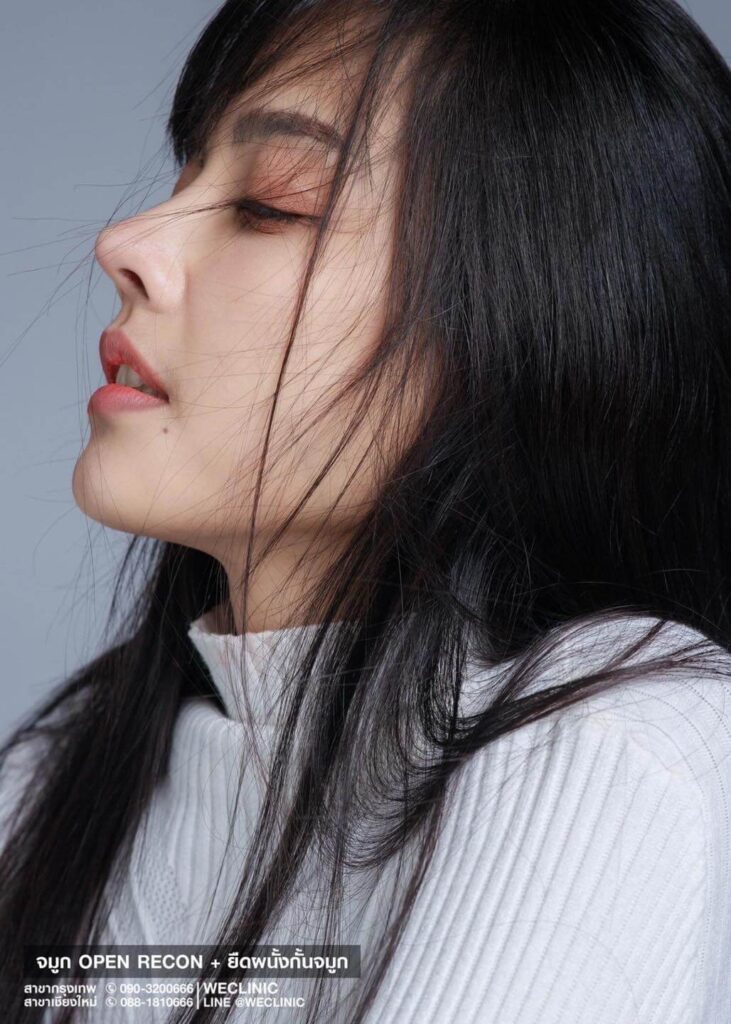 จมูกปลายพุ่ง