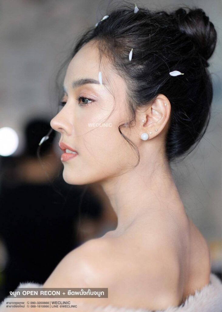 จมูกสโลปปลายพุ่ง