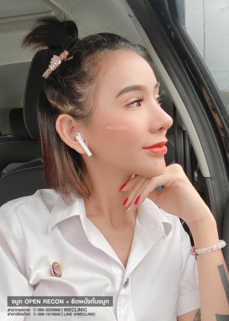 สโลปปลายพุ่ง