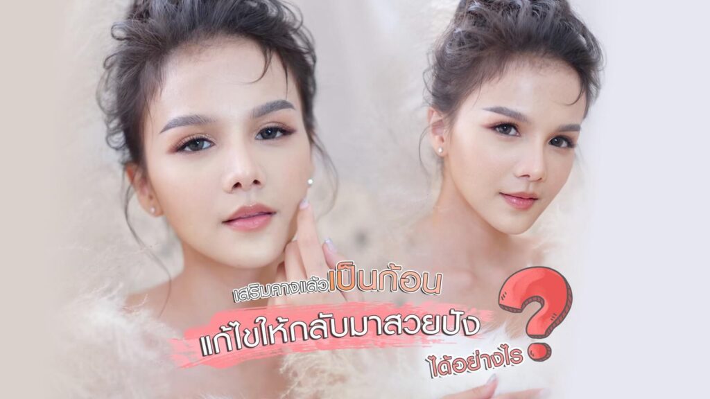 cover-01-เสริมคางแล้วเป็นก้อน ไม่สวยแก้ไขอย่างไร