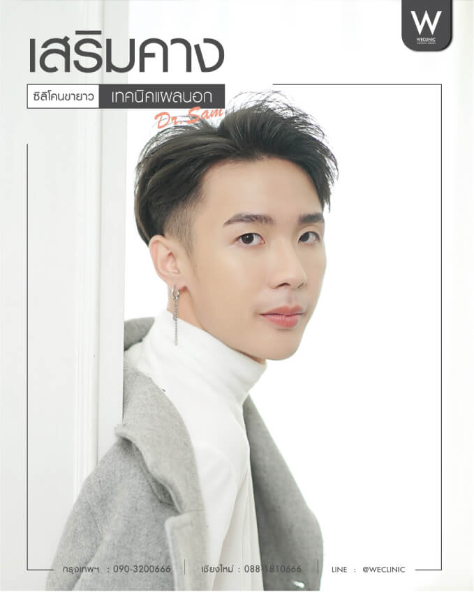 รีวิวทำคางผู้ชาย แผลนอก ซิลิโคนขายาว