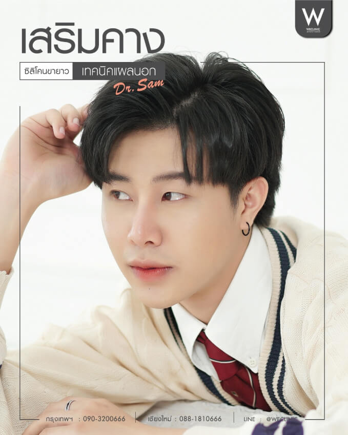 รีวิวหลังเสริมคาง ซิลิโคนขายาว แผลนอก