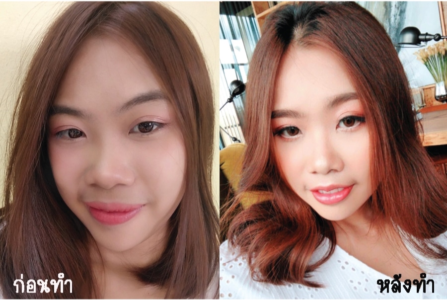 รีวิวก่อนทำหลังทำปากกระจับ