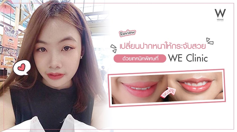 รีวิวปากกระจับ