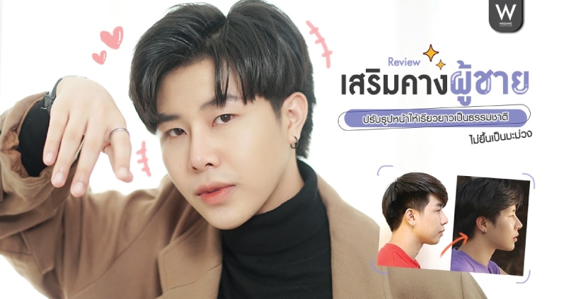 รีวิวเสริมคางผู้ชาย