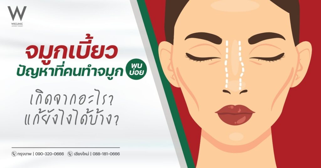 จมูกเบี้ยว ปัญหาที่คนทำจมูก พบบ่อย เกิดจากอะไร แก้ยังไงได้บ้าง