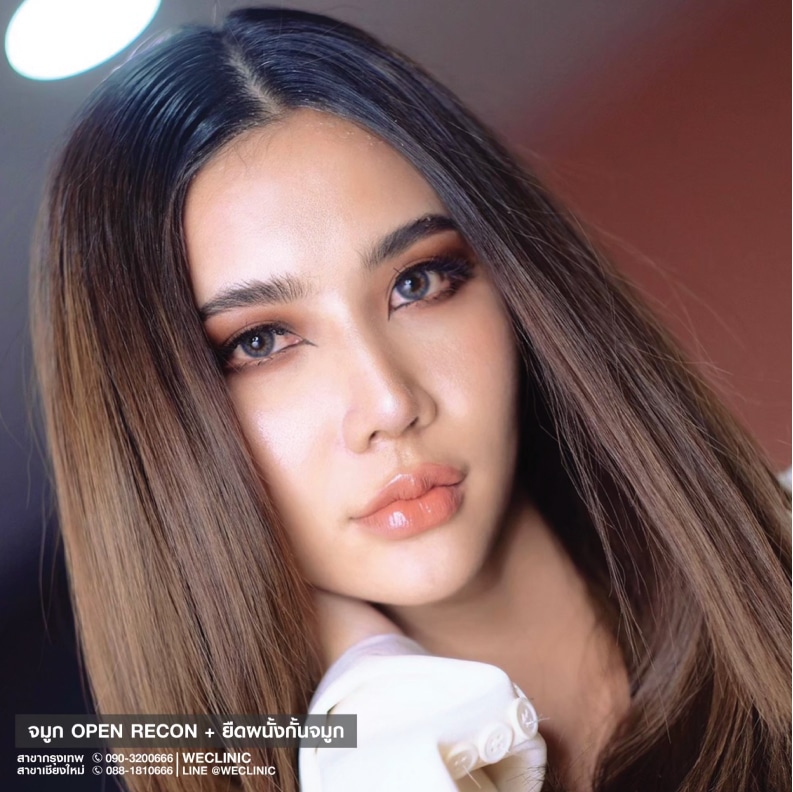 รีวิวทำจมูก