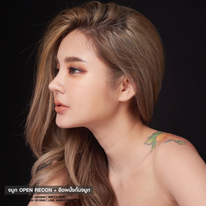 จมูกทรงสโลปปลายพุ่งธรรมชาติ