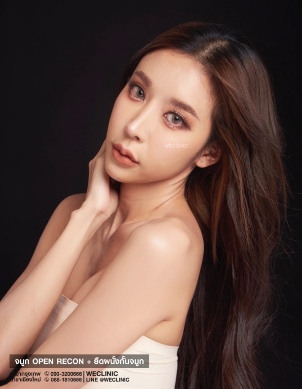 จมูกทรงหยดน้ำ คือ