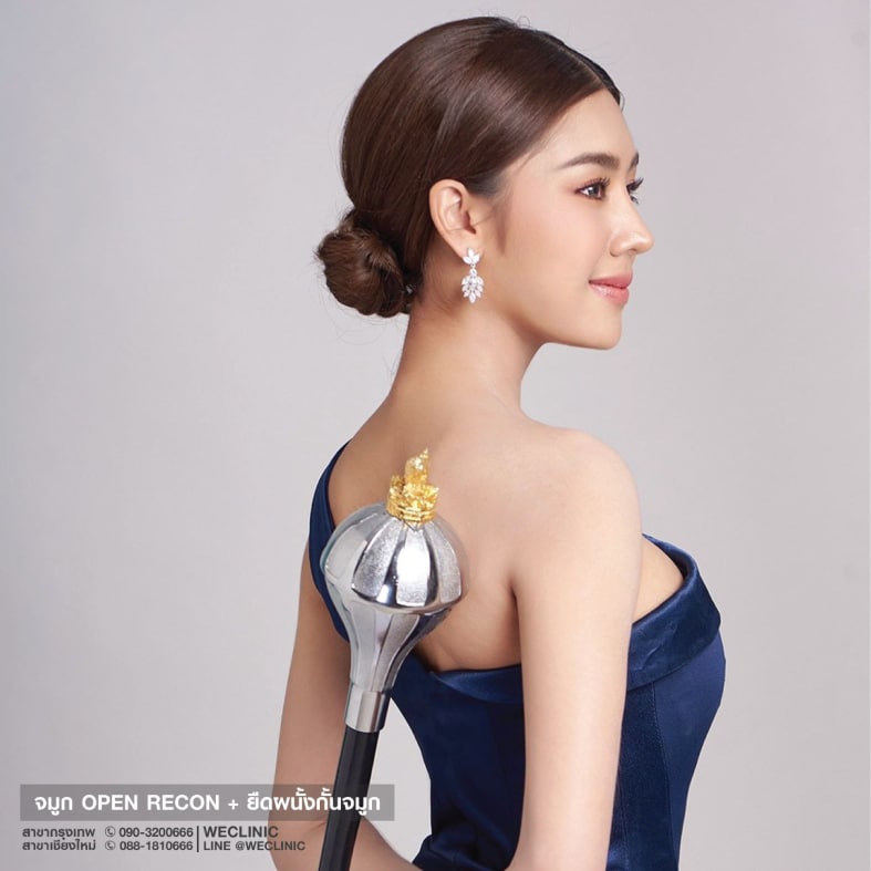 ทำจมูกโอเพ่น ทรงหยดน้ำ