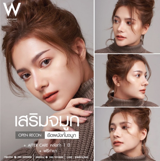 รีวิวทรงจมูกแบเกาหลี