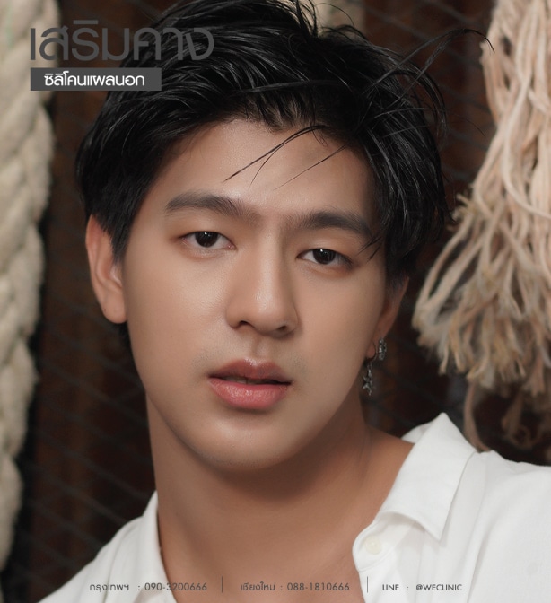 รีวิวทำคางผู้ชาย