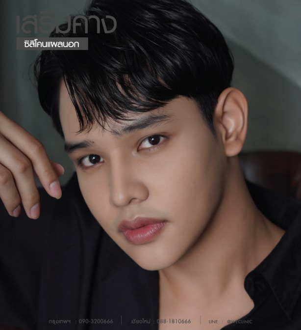 รีวิวเสริมคาง ผู้ชาย