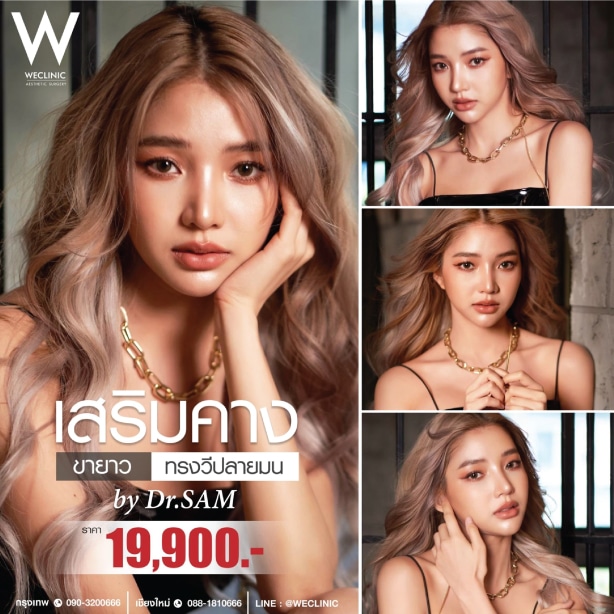 รีวิวเสริมคาง ราคา 19900