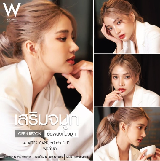 รีวิวเสริมจมูกแบบโอเพ่น ยืดผนังกั้นจมูก