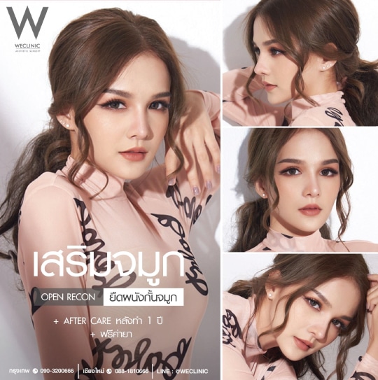 รีวิวเสริมจมูกแบบโอเพ่น