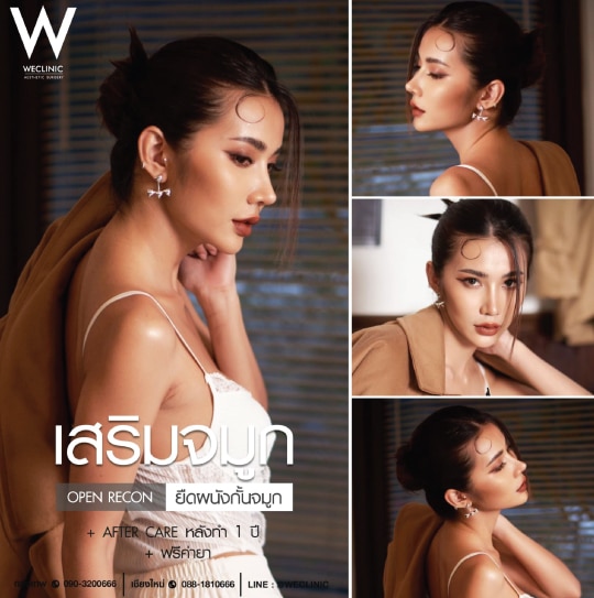 รีวิวเสริมจมูก Open ยืดผนังกั้นจมูก