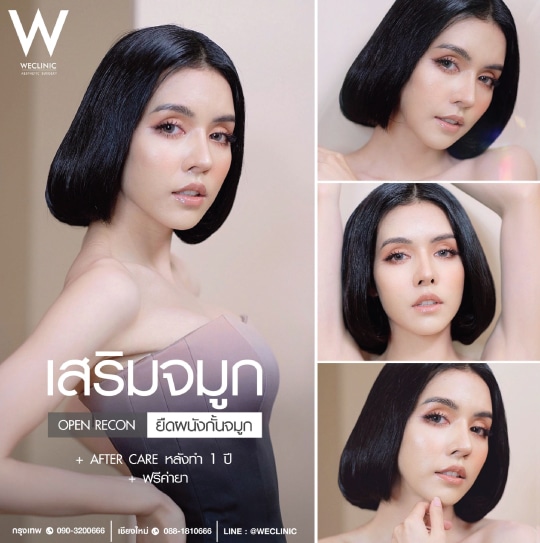 รีวิวเสริม Open ยืดผนังกั้นจมูก ละมุนเรียว