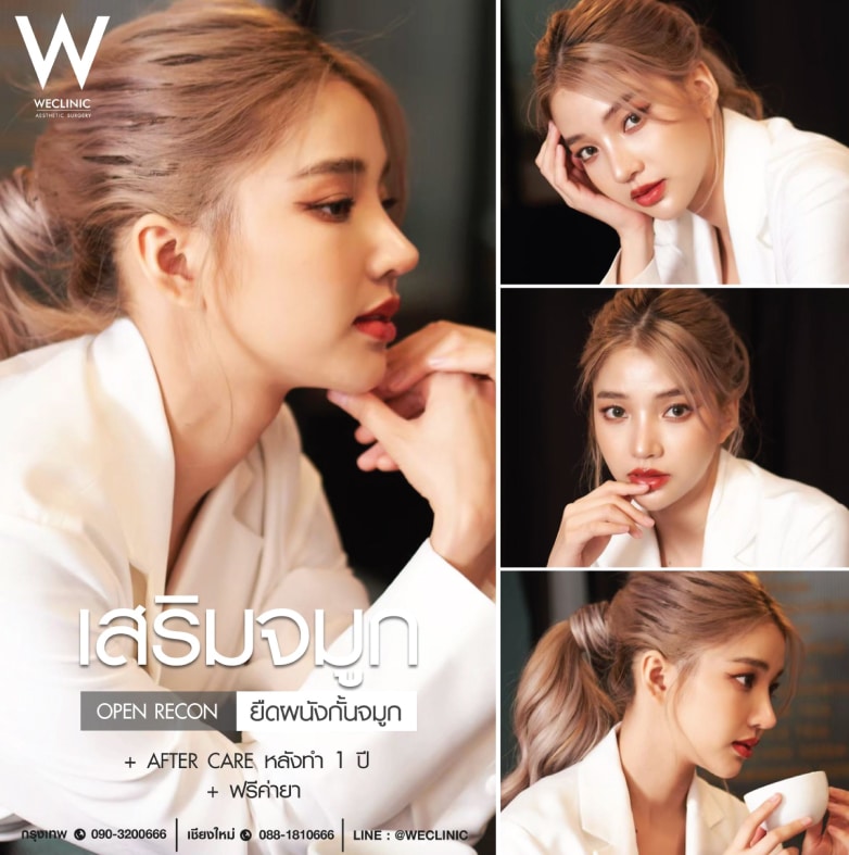 เสริมจมูก open ทรงจมูกหยดน้ำ