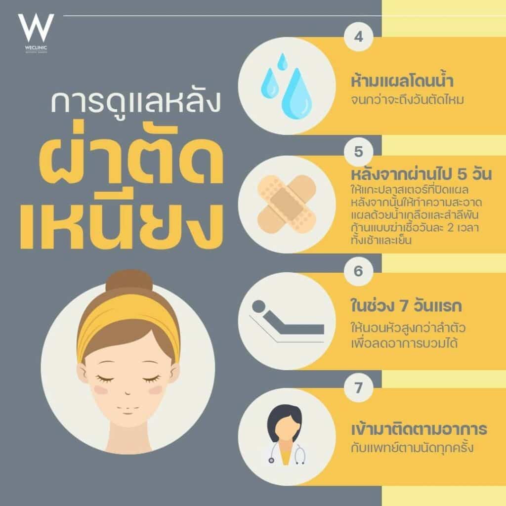 การดูแลหลังผ่าตัดเหนียง-02