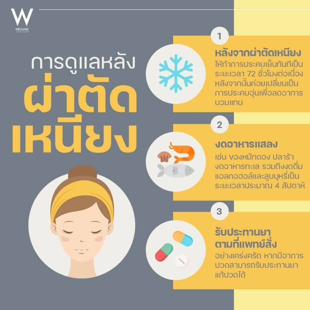 การดูแลหลังผ่าตัดเหนียง