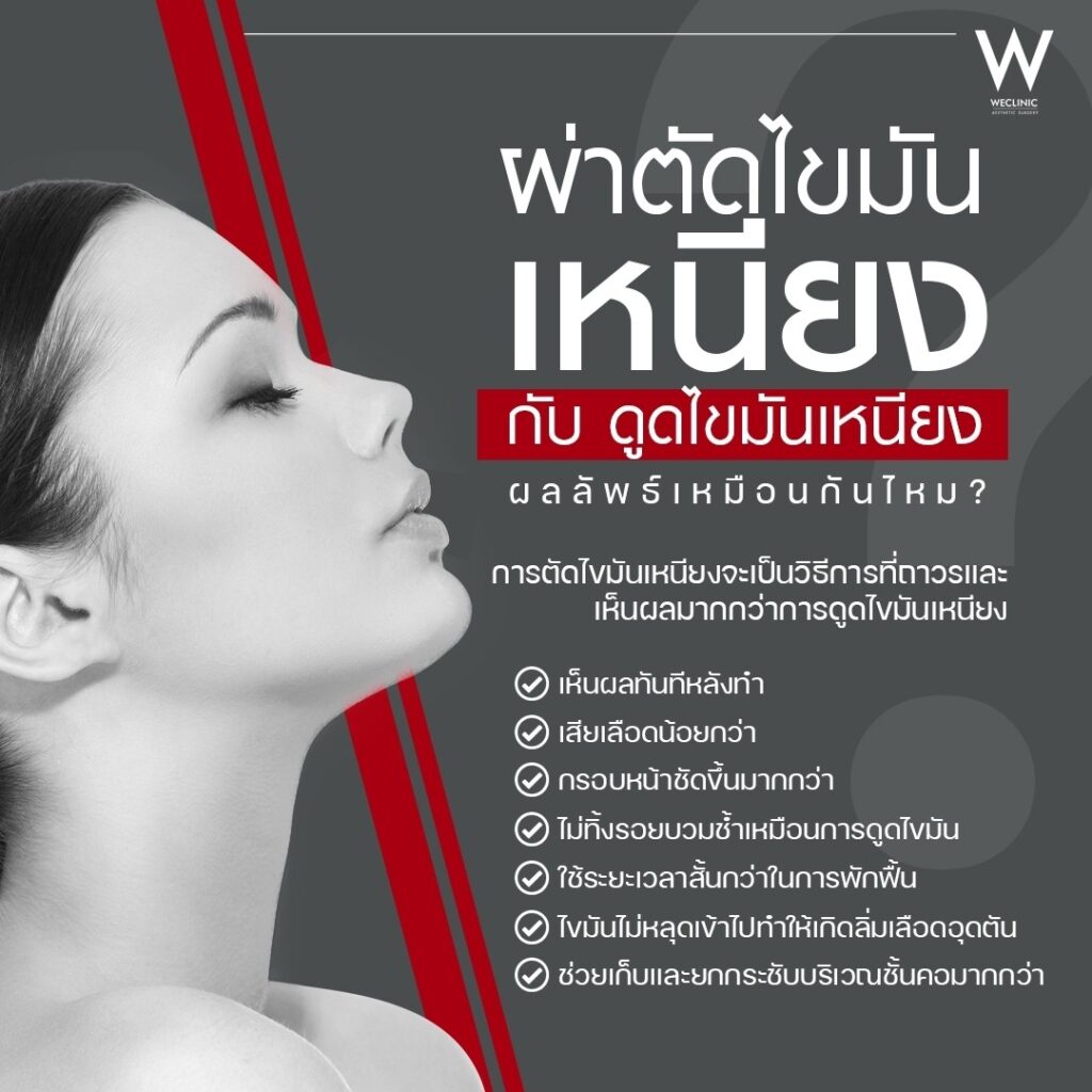 การผ่าตัดไขมันเหนียงกับดูดไขมันเหนียง