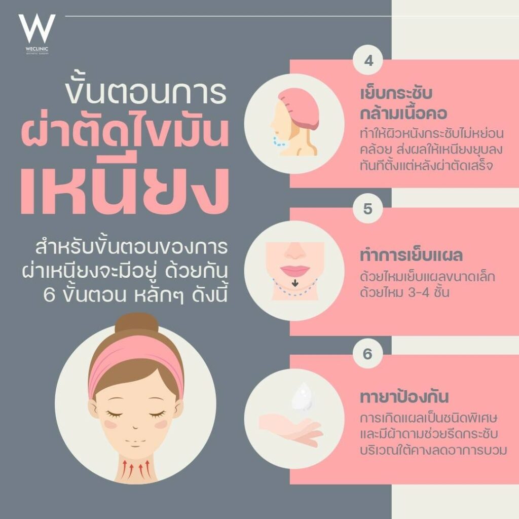 ขั้นตอนการผ่าตัดไขมันเหนียง-2