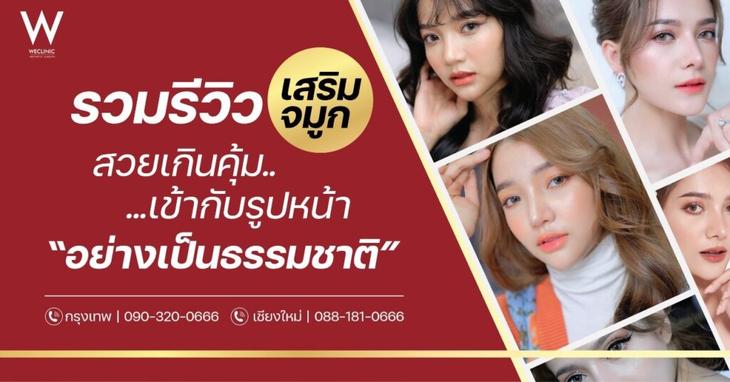 รวมรีวิวเสริมจมูก รีวิวทำจมูก สวยเกินคุ้ม เข้ากับรูปหน้า เป็นธรรมชาติ