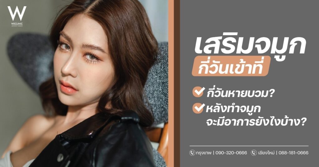 เสริมจมูกกี่วันเข้าที่ กี่วันหายบวม? หลังทำจมูกจะมีอาการยังไงบ้าง